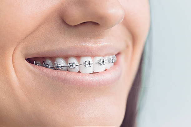 Best Tooth Extraction  in Dexter, MI